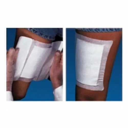 Adhesive Dressing WoundGard  6 X 6 Inch Gauze Square White Sterile Count of 30 By MPM Medical